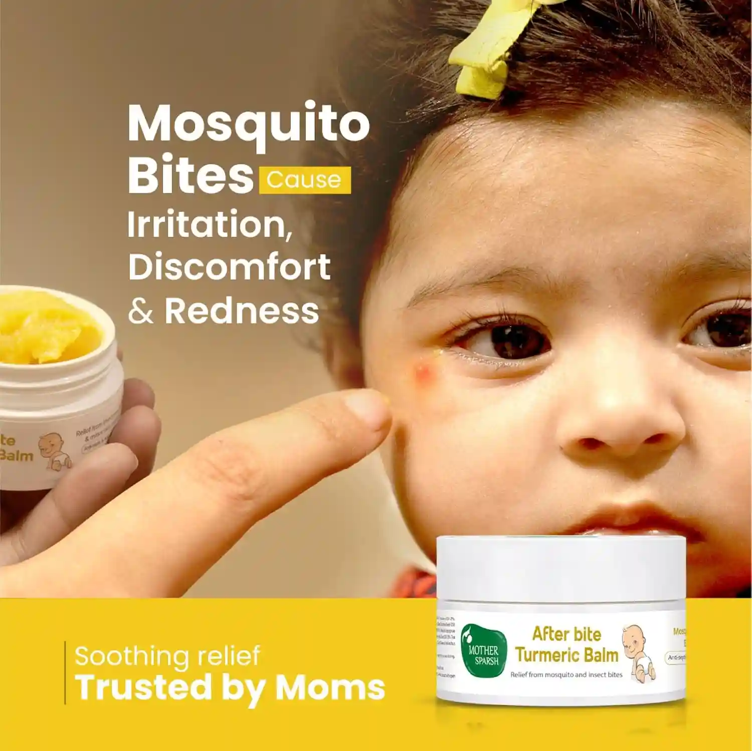 Mother Sparsh After Bite Turmeric Balm For Rashes And Mosquito Bites 100 Percent 25g - MSH-149558L1 - Image 2